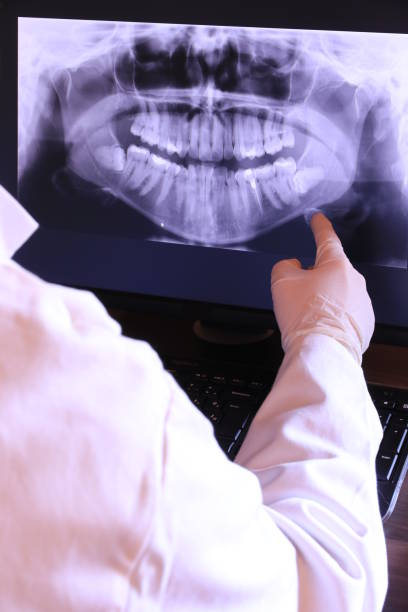 Best Emergency Root Canal Treatment in Camanche, IA