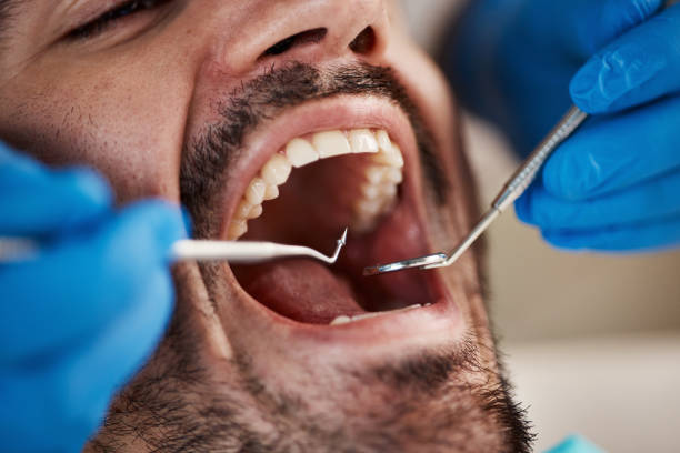 Best Weekend Emergency Dentist in Camanche, IA
