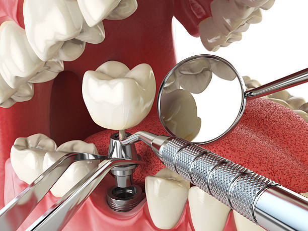 Best Mobile Emergency Dentist in Camanche, IA